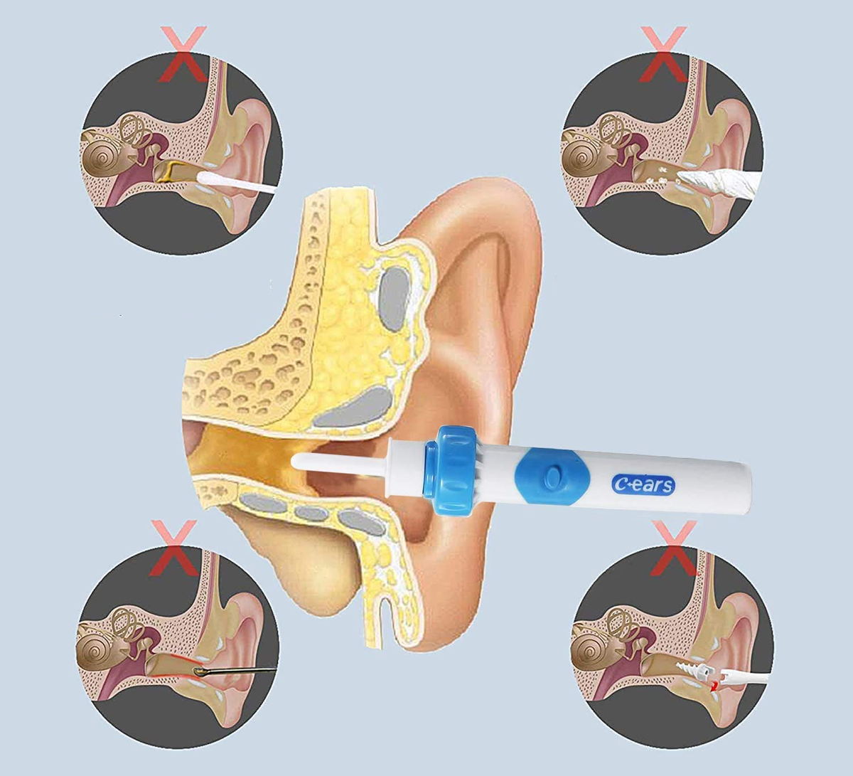 C-EARS dispositivo elettrico per la pulizia delle orecchie + custodia e spazzolino