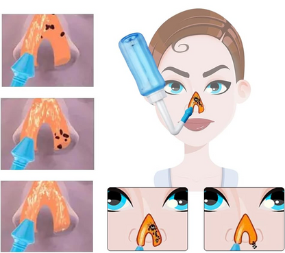 HOUDIAN Neti Pot neusirrigator voor kinderen en volwassenen 2 opzetstukken 300 ml